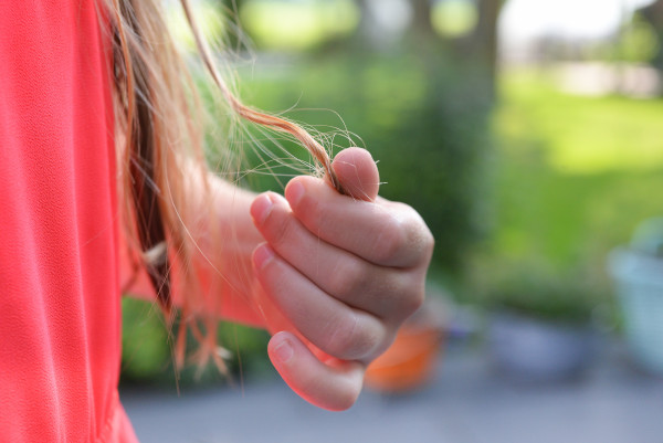 hair loss in women