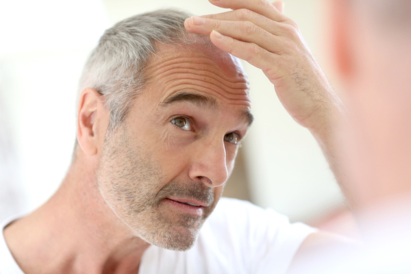 Senior man and hair loss issue